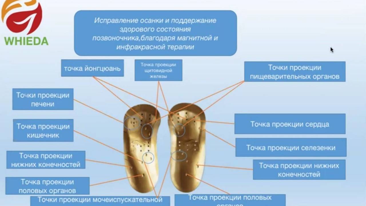 Для чего нужны магнитные стельки с анионами. Нормализуют проблемы вызванные искривлением костей.