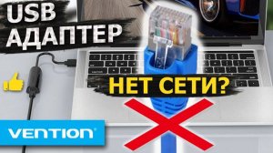 НЕТ СЕТИ? USB Gigabit сетевой адаптер Vention RJ45 вам поможет! Распаковка, установка и настройка.