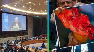 Взрывы пейджеров и других средств связи в Ливане в ООН назвали военными преступлениями