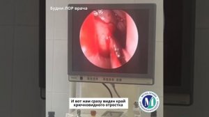 Фронтит и гайморит гнойный. Зондирование лобной и верхнечелюстной пазух.