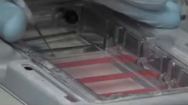 Haylees Story - Part 1