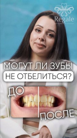 Могут ли зубы не отбелиться? #отбеливание #отбеливаниезубов #стоматолог