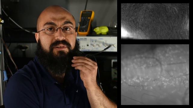 Specialized Sensory Neurons for Hair Pull Pain смотреть онлайн