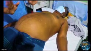 Examination Of Abdomen | Dr.Lalindra Dias | Real-Time Live Demonstration