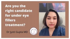 Under Eye Fillers Treatment: Are you the right candidate fir under eye fillers treatment?