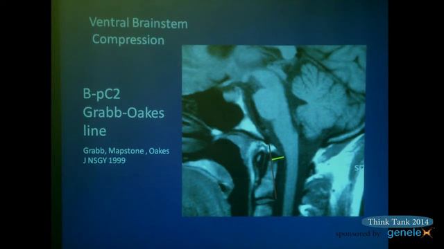 Fraser Henderson, MD, Day Two Think Tank 2014 смотреть онлайн