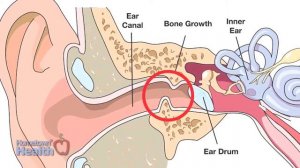 Lake Ear, Nose, Throat and Facial Plastic Surgery: Don't Stick It In Your Ear