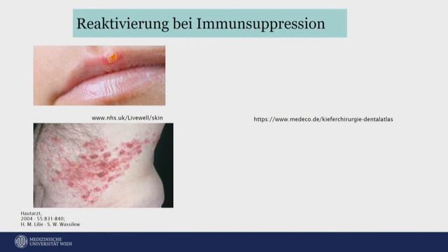 Was sind Viren? Und wie kann man sich schützen? смотреть онлайн