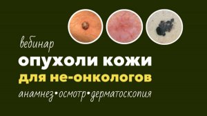 Опухоли кожи для не-онкологов.