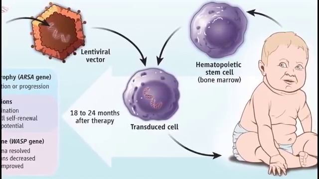 Синдром олдрича что это. Синдром вискотта олдрича. Синдром олдрича что это. Синдром олдрича что это. Синдром олдрича что это.