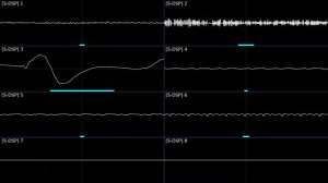 Yuzo Koshiro - "Jungle Chase" (Super Adventure Island, SNES) [Oscilloscope Visualization]