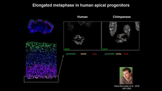 Svante Pääbo: 2017 Breakthrough Prize Symposium