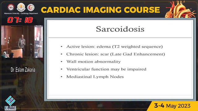RCM  Amyloidosis sarcoidosis EMF iron overload  - Dr. Eslam Zakaria