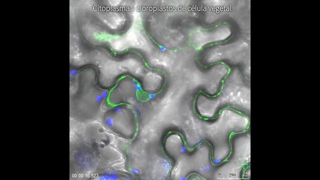 Microscopía confocal: Sylvia Gutiérrez Erlandsson смотреть онлайн