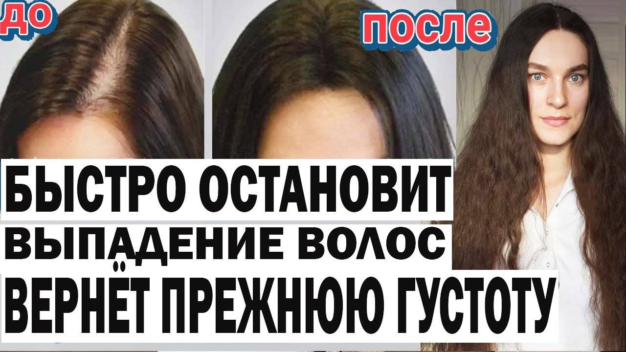 Бабушкино средство. УСКОРИТ рост волос и ОСТАНОВИТ выпадение