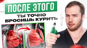 Кальяны,одноразки и стики опаснее ,чем СИГАРЕТЫ!? Вот что КУРЕНИЕ творит с твоим организмом.