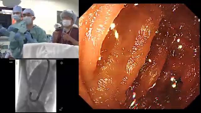 TOKYO Live 2019 Dr Kazuo Ohtsuka 1 2 смотреть онлайн