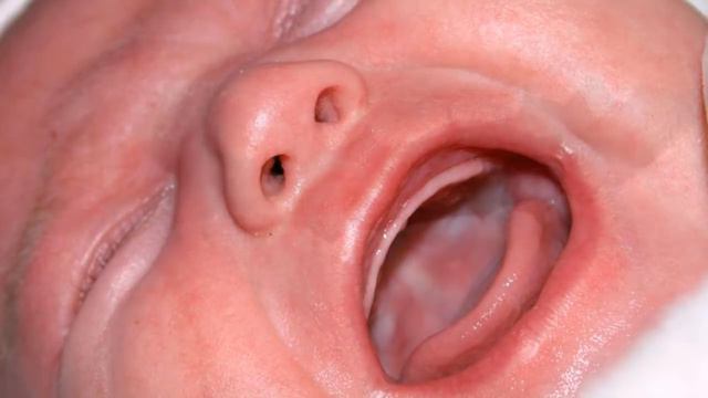 Огиз Чакалари Ва Яраларини Даволаш Сирлари...