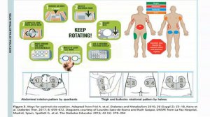 DIABETES MELLITUS: CARE AND MANAGEMENT 2/3