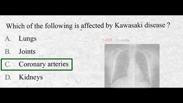 Old Staff Nurse Exam papers for 2022 Nursing Exam смотреть онлайн