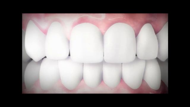 Vicco Vajradanti Herbal ToothPaste for Strong Gums and Healthy Teeth смотреть онлайн