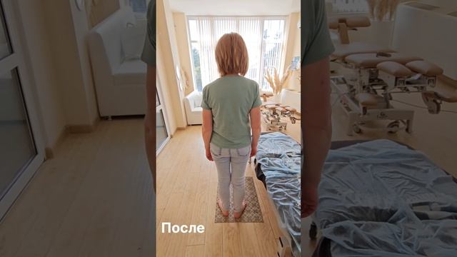 Ограничение подвижности с 2018 года. Причина шрамы и рецепторы♂️ #квантоваякоррекция #мастерхруст
