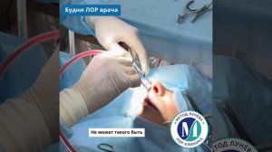 Септопластика под местной анестезией.