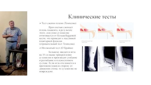 "Боль в стопе. Междисциплинарная проблема".