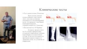 "Боль в стопе. Междисциплинарная проблема".