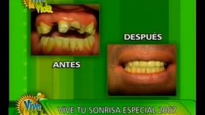 Vive tu Sonrisa.flv