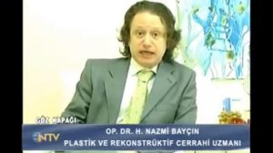 Eyelid Surgery | Op. Dr. Nazmi Baycin