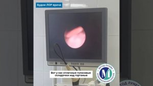 Фиброларингоскопия - детальный осмотргортани.