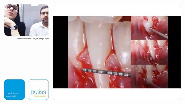 Recubrimiento radicular: Desafiando Conceptos смотреть онлайн