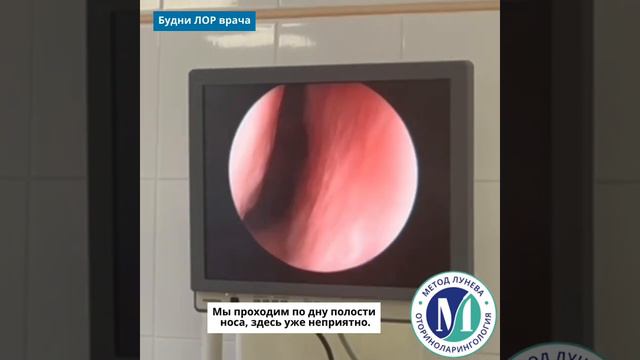 Видеопаспорт ЛОР-органов