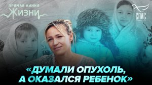 ЧУДО РОЖДЕНИЯ ВОПРЕКИ СТРАШНОМУ ДИАГНОЗУ. ПРЯМАЯ ЛИНИЯ ЖИЗНИ