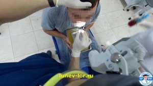 Лечение гайморита без прокола. Зондирование верхнечелюстных пазух через естественное соустье.