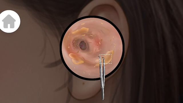 [Asmr]Asmr Ear cleaning | Ear cleaning asmr | Asrm Satisfying Ear Cleaning