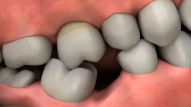 Dental implants Langhorne, Dental implants Newtown, Dental implants Yardley смотреть онлайн