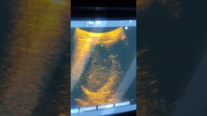 Практическое занятие 4. УЗИ органов брюшной полости (Неласов Н.Ю.)