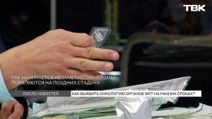 Выявление онкологии органов ЖКТ на ранних сроках
