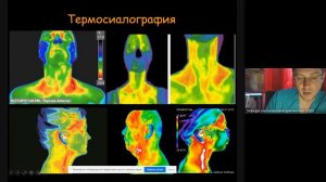 Ультразвуковая диагностика патологии слюнных желез  Часть 2 2021 11 22 at 04 04 GMT 8