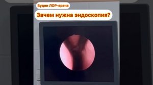 Зачем нужна эндоскопия полости носа?