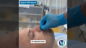 Зондирование лобной пазухи.
