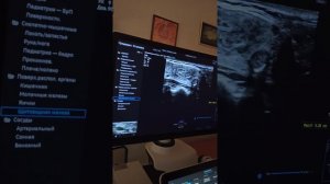 Практическое занятие 3.1. (начало). УЗИ щитовидной железы (Паленый А.И.)