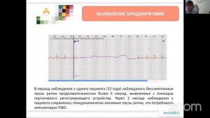 Современные устройства для длительного телемониторирования ЭКГ: преимущества и недостатки
