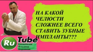 Имплант 14.На какой челюсти сложнее всего ставить зубные импланты? #имплант #имплантация зубов#dent