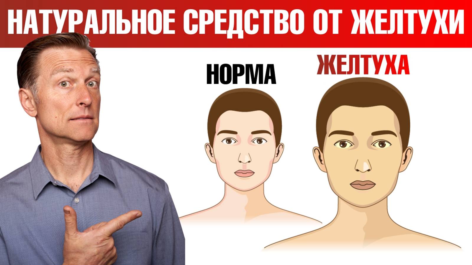 Что такое желтуха? Натуральные средства от желтухи🙌