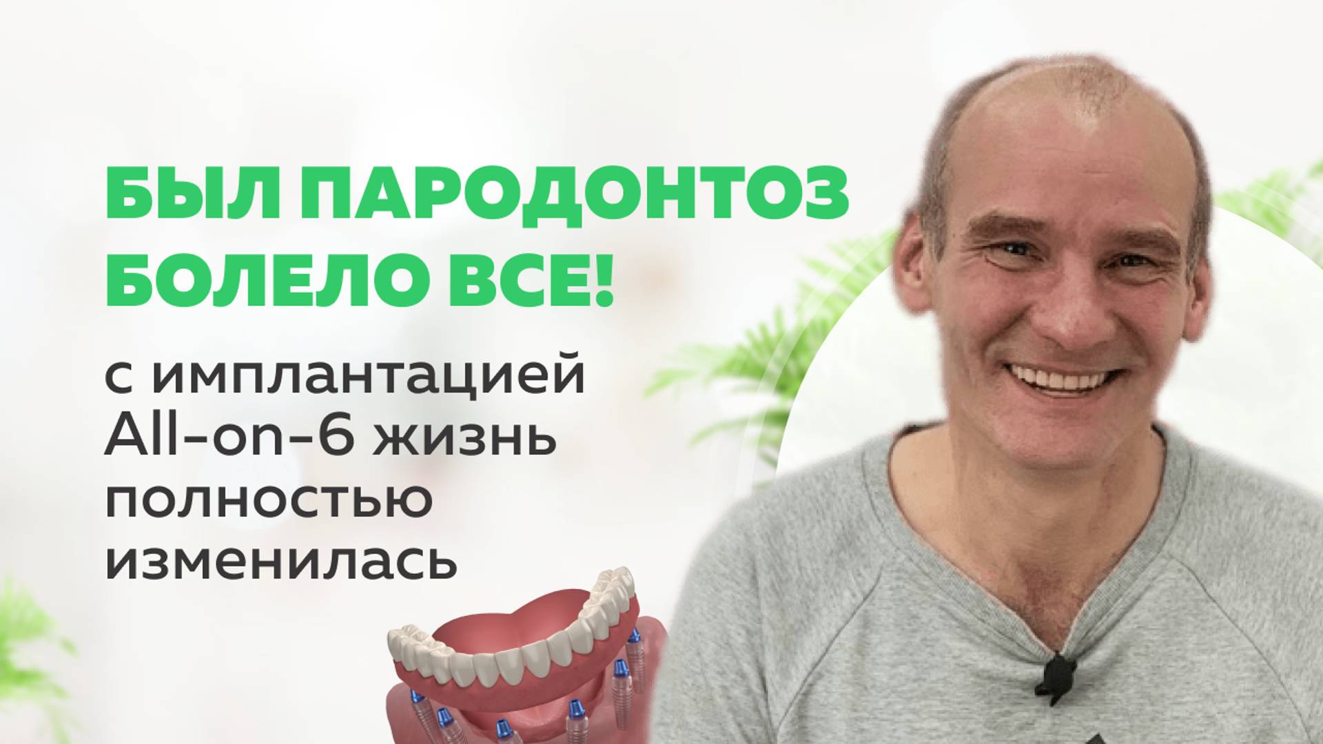 "Пародонтоз. Болело все!" Имплантация All-on-6 стала спасением
