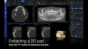Planmeca Romexis Quick Guide for 3D Implant Planning