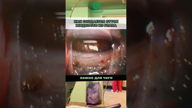 Операция по поводу глаукомы